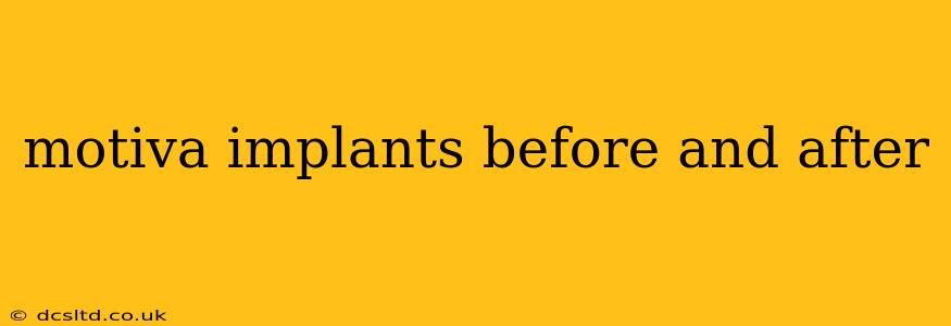 motiva implants before and after