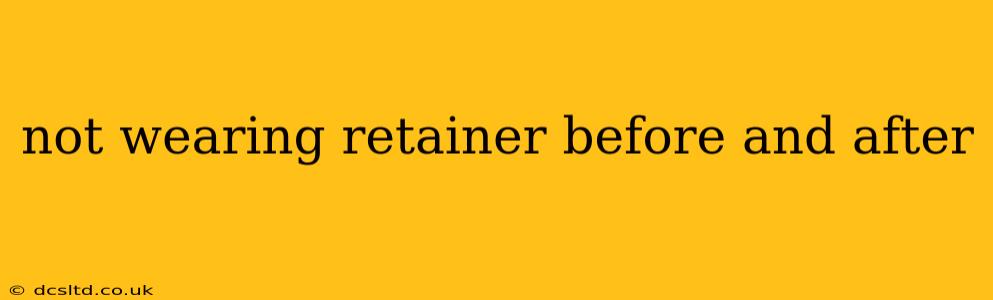 not wearing retainer before and after