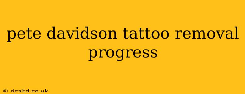 pete davidson tattoo removal progress