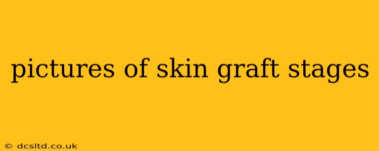 pictures of skin graft stages