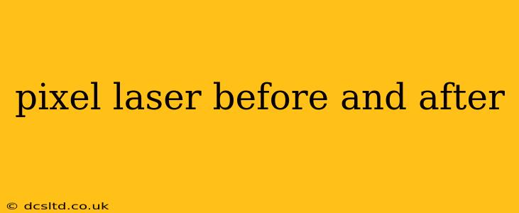 pixel laser before and after