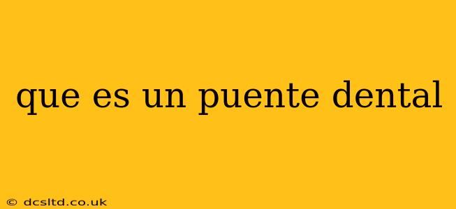 que es un puente dental