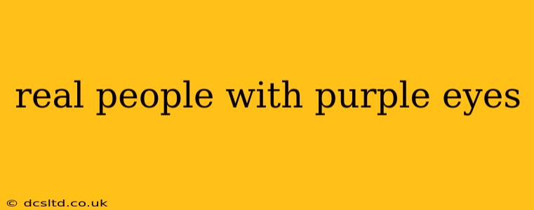 real people with purple eyes