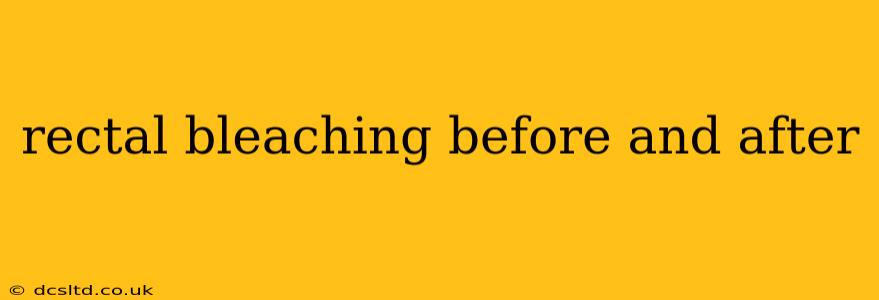 rectal bleaching before and after