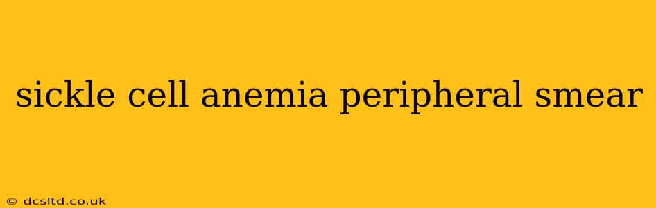 sickle cell anemia peripheral smear