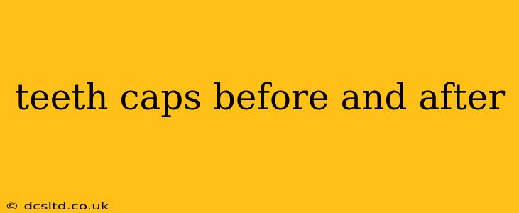 teeth caps before and after