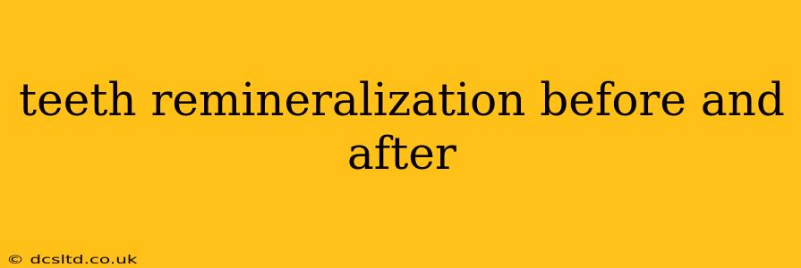 teeth remineralization before and after