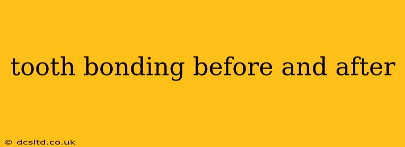tooth bonding before and after