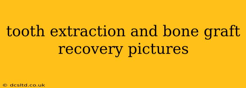 tooth extraction and bone graft recovery pictures