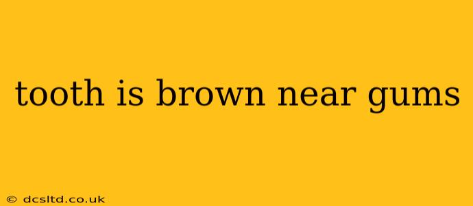 tooth is brown near gums