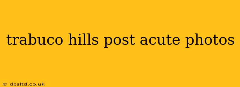 trabuco hills post acute photos