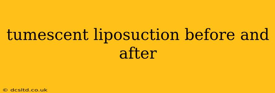 tumescent liposuction before and after