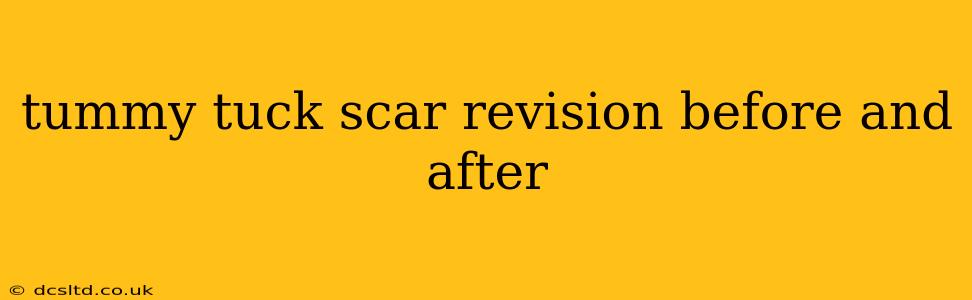 tummy tuck scar revision before and after
