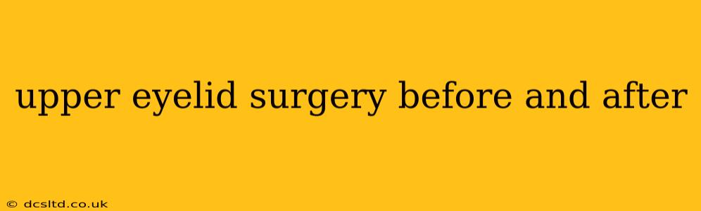 upper eyelid surgery before and after