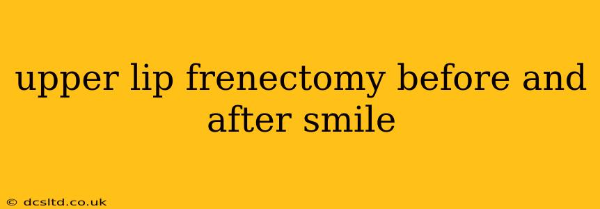 upper lip frenectomy before and after smile