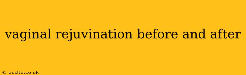 vaginal rejuvination before and after
