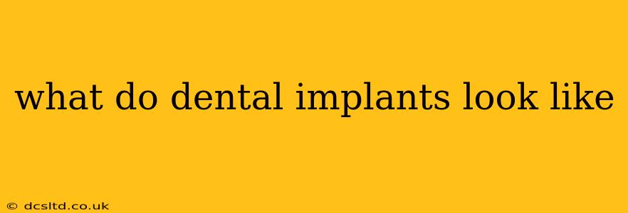 what do dental implants look like
