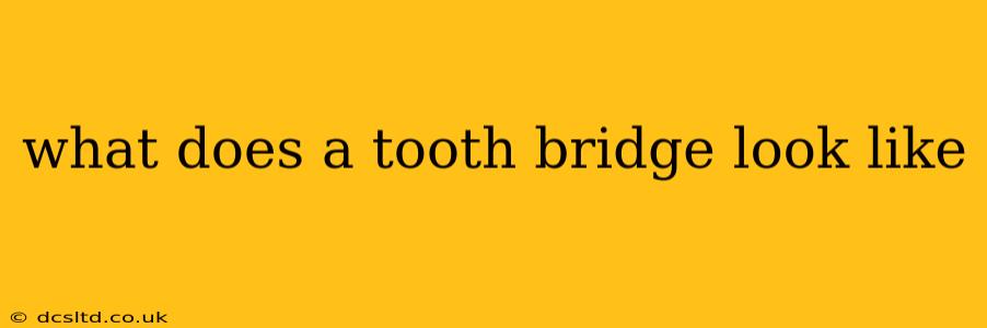 what does a tooth bridge look like