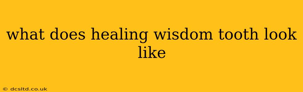 what does healing wisdom tooth look like