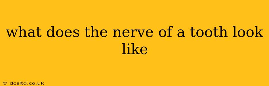 what does the nerve of a tooth look like