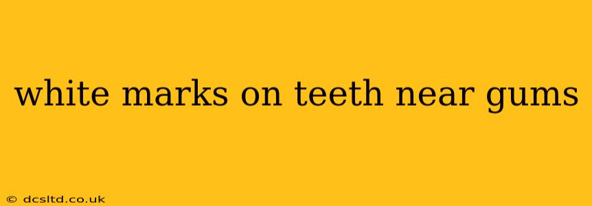 white marks on teeth near gums