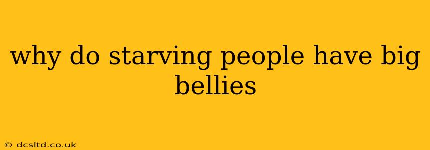 why do starving people have big bellies
