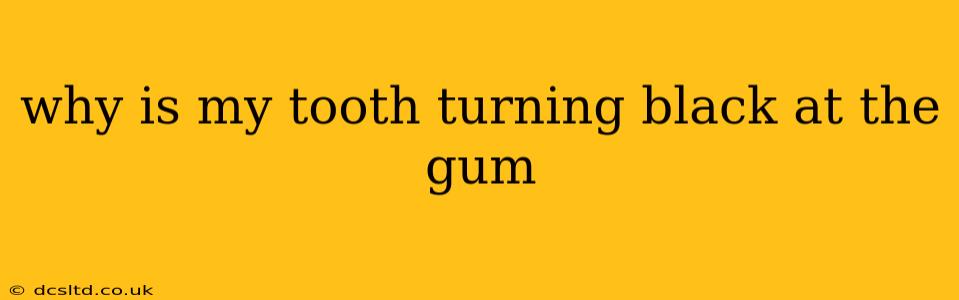 why is my tooth turning black at the gum