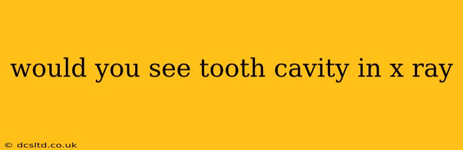 would you see tooth cavity in x ray